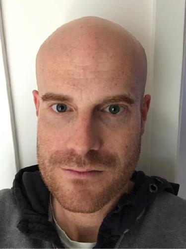 Tim Skirde