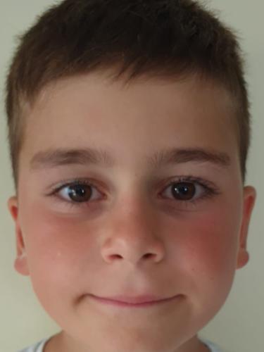 Toni Bonatb