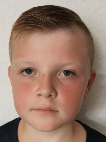 Pepe Eiert