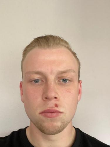 Bosse Klug