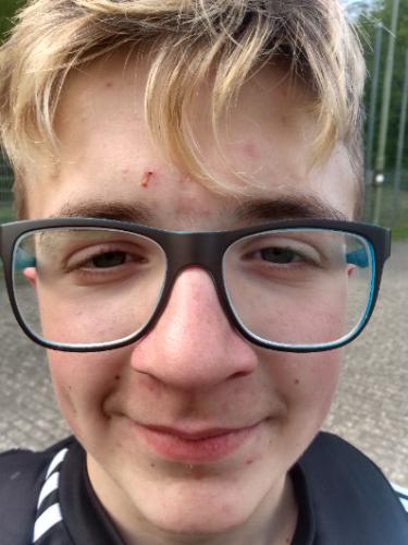 Fynn-Luca Albinger
