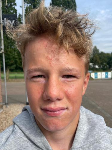 Anton Heinrich Ter Horst