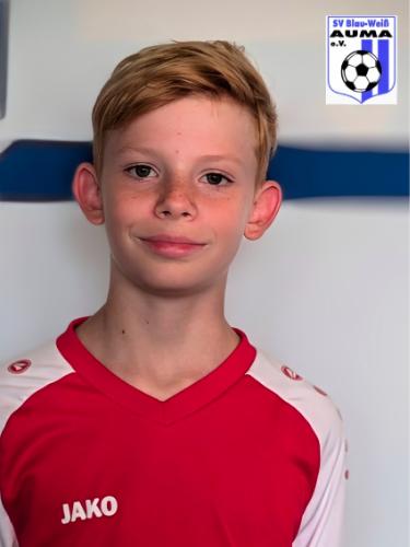 Mateo Tietze