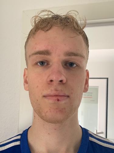Lukas Alois Zumstrull