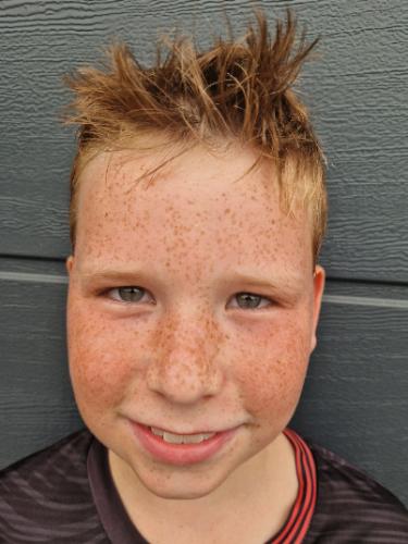 Ben Fronz