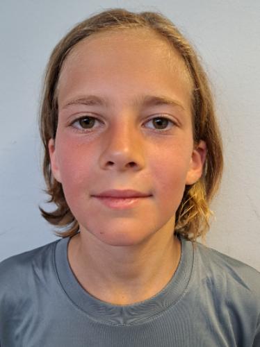 Luc Bergmann