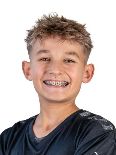 Moritz Plewa