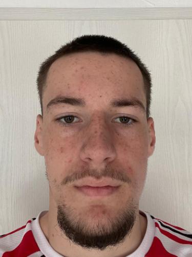 Fabio Noserke