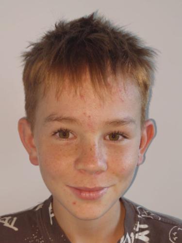 Nils Lemal