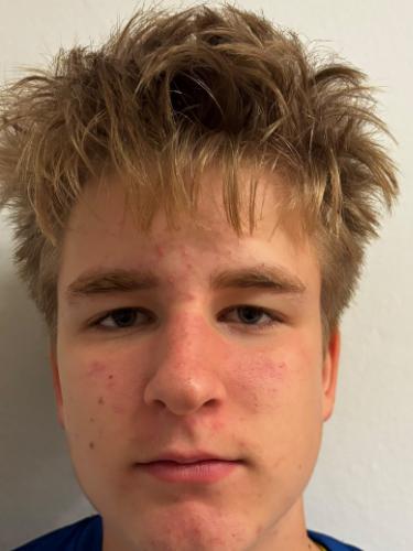 Leonhard Staschill